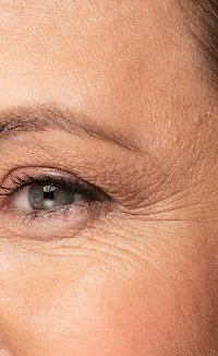 Kırışıklık İnce Çizgiler