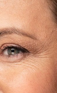 Kırışıklık İnce Çizgiler